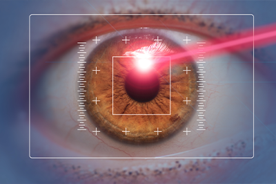 Plattsburgh LASIK Eye Doctor