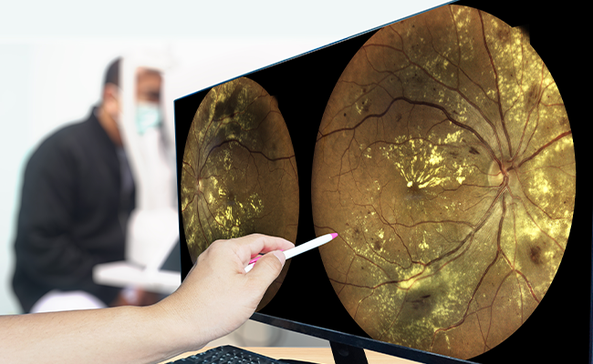 Plattsburgh Eye Doctor